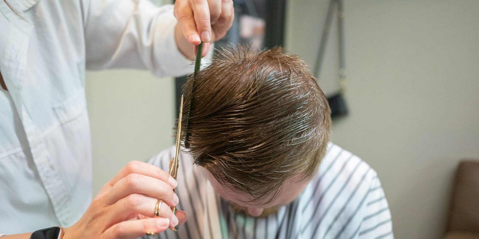 Breakthrough Hair Regrowth Therapy Shows Promise in Male Mice